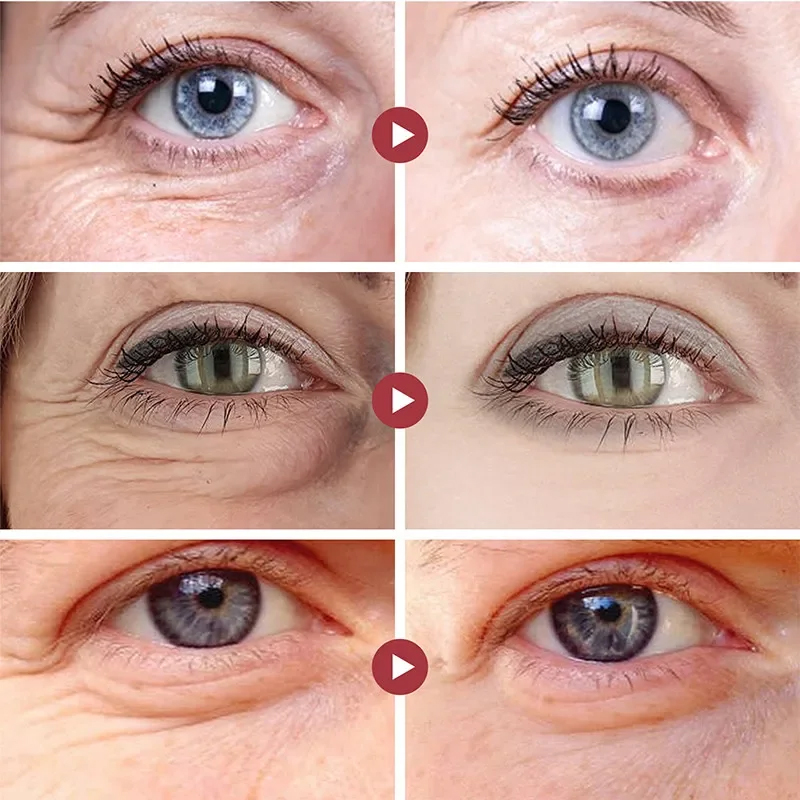 Wrinkle Remove Eyes Patches Fi - Eye Pad Collagen review and price